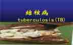 结核病日活动总结7篇